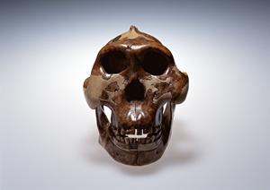 群馬でインプラント治療を成功に導く最新ガイド【2025年版】